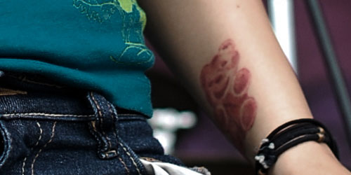 Krysta Cameron gummy bear tattoo